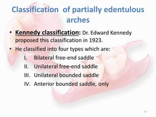 Classification of partially edentulous
arches
• Kennedy classification: Dr. Edward Kennedy
proposed this classification in 1923.
• He classified into four types which are:
I. Bilateral free-end saddle
II. Unilateral free-end saddle
III. Unilateral bounded saddle
IV. Anterior bounded saddle, only
23
 