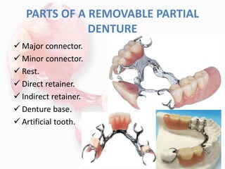 PARTS OF A REMOVABLE PARTIAL
DENTURE
 Major connector.
 Minor connector.
 Rest.
 Direct retainer.
 Indirect retainer.
 Denture base.
 Artificial tooth.
33
 