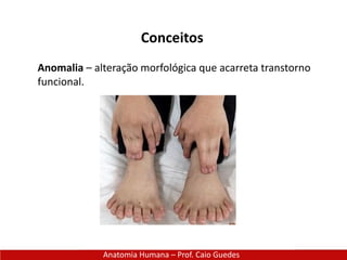 Anatomia Humana – Prof. Caio Guedes
Conceitos
Anomalia – alteração morfológica que acarreta transtorno
funcional.
 