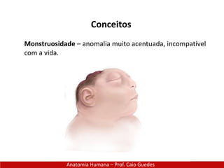 Anatomia Humana – Prof. Caio Guedes
Conceitos
Monstruosidade – anomalia muito acentuada, incompatível
com a vida.
 