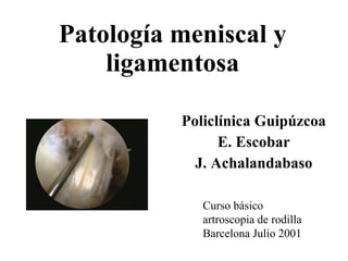 Patología meniscal y ligamentosa Policlínica Guipúzcoa E. Escobar J. Achalandabaso Curso básico  artroscopia de rodilla Barcelona Julio 2001 
