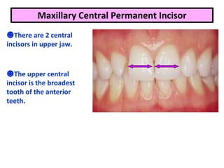 Maxillary Central Permanent Incisor
☻There are 2 central
incisors in upper jaw.
☻The upper central
incisor is the broadest
tooth of the anterior
teeth.
 