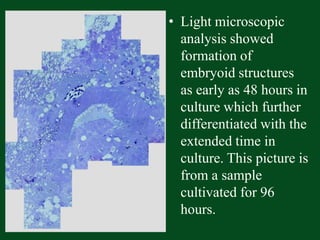 Light microscopic analysis showed formation of embryoid structures as early as 48 hours in culture which further differentiated with the extended time in culture. This picture is from a sample cultivated for 96 hours.