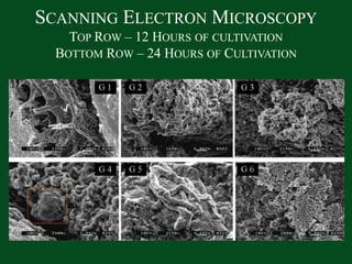 Scanning Electron MicroscopyTop Row – 12 Hours of cultivationBottom Row – 24 Hours of Cultivation 