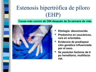 Estenosis hipertrófica de píloro
(EHP)
 Etiología: desconocida.
 Predomina en caucásicos,
rara en orientales.
 Evidencia de predisposi
ción genética influenciada
por el sexo.
 Se postulan factores de ti
po hereditario, multifacto
rial.
Causa más común de OIN después de 2a semana de vida
 