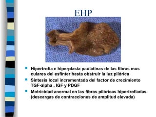 EHP
 Hipertrofia e hiperplasia paulatinas de las fibras mus
culares del esfínter hasta obstruir la luz pilórica
 Síntesis local incrementada del factor de crecimiento
TGF-alpha , IGF y PDGF
 Motricidad anormal en las fibras pilóricas hipertrofiadas
(descargas de contracciones de amplitud elevada)
 