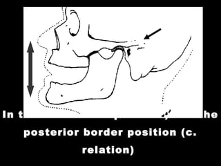 Border Position 01 occlusion in prosthodontics introduction - stomatognathic system ...