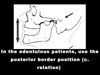 Border Position 01 occlusion in prosthodontics introduction - stomatognathic system ...