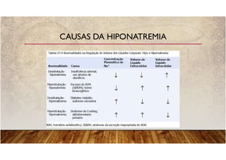 CAUSAS DA HIPONATREMIA
 