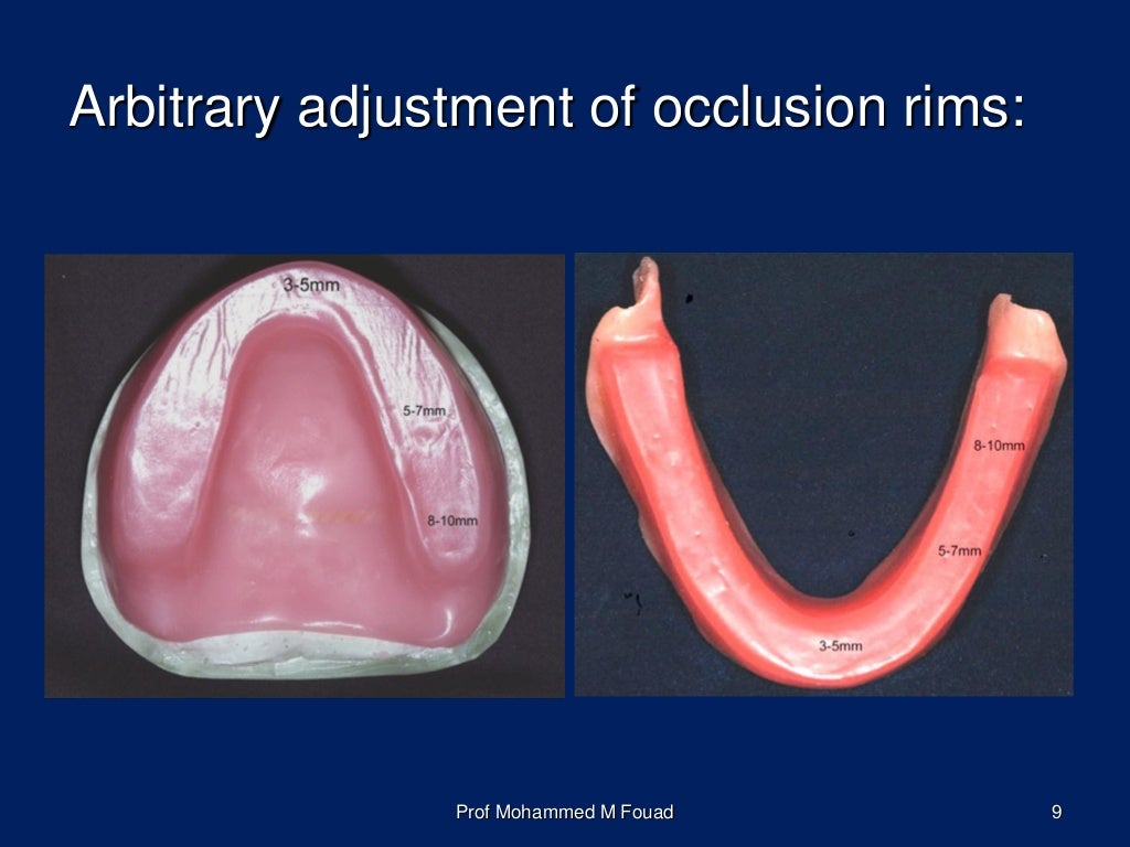 The Registration of Jaw Relations for Completely Edentulous Patient