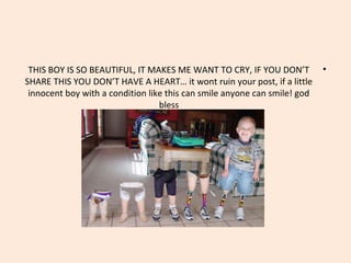 THIS BOY IS SO BEAUTIFUL, IT MAKES ME WANT TO CRY, IF YOU DON’T •
SHARE THIS YOU DON’T HAVE A HEART… it wont ruin your post, if a little
innocent boy with a condition like this can smile anyone can smile! god
bless