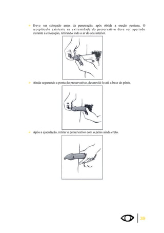 ¾Deve ser colocado antes da penetração, após obtida a ereção peniana. O 
receptáculo existente na extremidade do preservativo deve ser apertado 
durante a colocação, retirando todo o ar do seu interior. 
39 
¾Ainda segurando a ponta do preservativo, desenrolá-lo até a base do pênis. 
¾Após a ejaculação, retirar o preservativo com o pênis ainda ereto. 
 