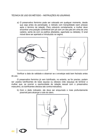 TÉCNICA DE USO DO MÉTODO – INSTRUÇÕES ÀS USUÁRIAS 
44 
a) O preservativo feminino pode ser colocado em qualquer momento, desde 
que seja antes da penetração, e retirado com tranqüilidade (sem pressa) 
após o término da relação. Para colocá-lo corretamente, a mulher deve 
encontrar uma posição confortável (em pé com um dos pés em cima de uma 
cadeira, senta da com os joelhos afastados, agachada ou deitada). O anel 
móvel deve ser apertado e introduzido na vagina. 
Verificar a data de validade e observar se o envelope está bem fechado antes 
do uso. 
O preservativo feminino já vem lubrificado, no entanto, se for preciso, podem 
ser usados lubrificantes de base aquosa ou oleosos (não esqueça de lembrar a 
mulher que, se ocorrer a oportunidade de relação sexual com o preservativo 
masculino, os lubrificantes oleosos são contra-indicados). 
b) Com o dedo indicador, ele deve ser empurrado o mais profundamente 
possível para alcançar o colo do útero. 
 