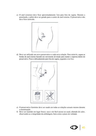 c) O anel (externo) deve ficar aproximadamente 3cm para fora da vagina. Durante a 
penetração, o pênis deve ser guiado para o centro do anel externo. O preservativo não 
deve ficar retorcido. 
d) Deve ser utilizado um novo preservativo a cada nova relação. Para retirá-lo, segure as 
bordas do anel externo fazendo um movimento de torção para manter o esperma dentro do 
preservativo. Puxe-o delicadamente para fora da vagina, jogando-o no lixo. 
e) O preservativo feminino deve ser usado em todas as relações sexuais mesmo durante 
45 
a menstruação. 
f) Deve ser mantido em lugar fresco, seco e de fácil acesso ao casal, afastado do calor, 
observando-se a integridade da embalagem, bem como o prazo de validade. 
 