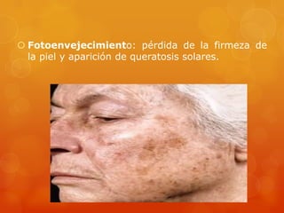  Fotoenvejecimiento: pérdida de la firmeza de
la piel y aparición de queratosis solares.
 
