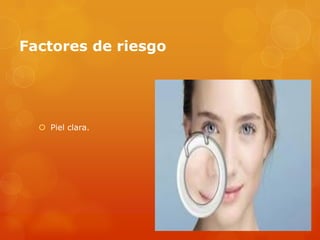 Factores de riesgo
 Piel clara.
 