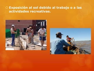  Exposición al sol debido al trabajo o a las
actividades recreativas.
 