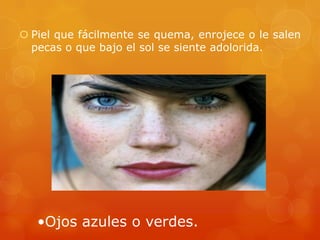  Piel que fácilmente se quema, enrojece o le salen
pecas o que bajo el sol se siente adolorida.
•Ojos azules o verdes.
 