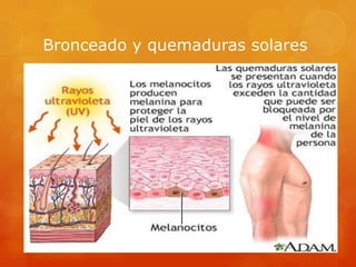 Bronceado y quemaduras solares
 