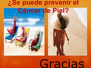 ¿Se puede prevenir el
Cáncer de Piel?
 