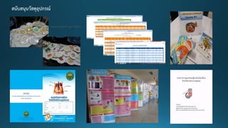 สนับสนุนวัสดุอุปกรณ์
 