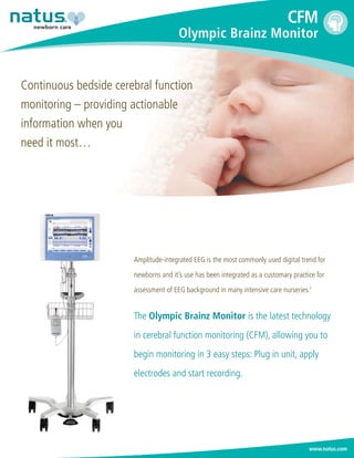 Continuous bedside cerebral function
monitoring – providing actionable
information when you
need it most…
newborn care
www.natus.com
Amplitude-integrated EEG is the most commonly used digital trend for
newborns and it’s use has been integrated as a customary practice for
assessment of EEG background in many intensive care nurseries.1
The Olympic Brainz Monitor is the latest technology
in cerebral function monitoring (CFM), allowing you to
begin monitoring in 3 easy steps: Plug in unit, apply
electrodes and start recording.
CFM
Olympic Brainz Monitor
 