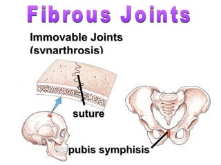 Immovable JointsImmovable Joints
(synarthrosis)(synarthrosis)
suturesuture
pubis symphisispubis symphisis
 
