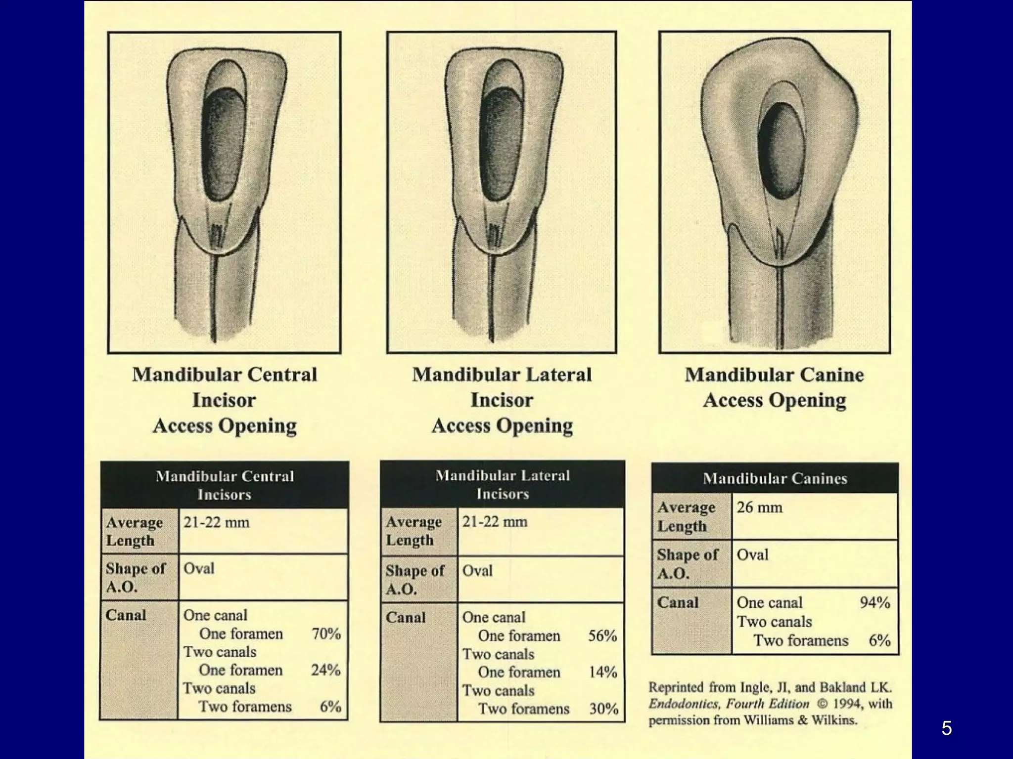 012. access cavity preparation | PPT