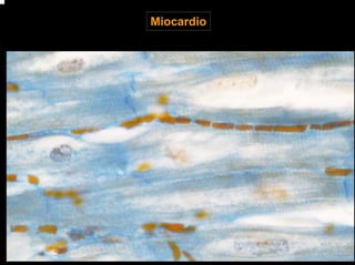 Miocardio
 