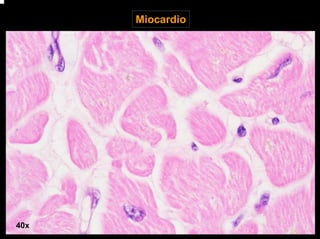 Miocardio
40x
 