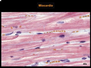 Miocardio
40x
 
