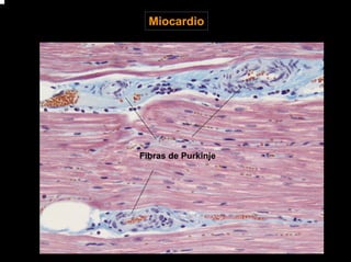Miocardio
Fibras de Purkinje
 