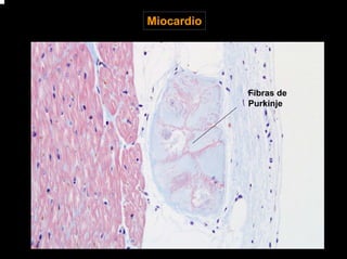 Miocardio
Fibras de
Purkinje
 