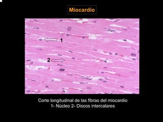 Miocardio
2
1
Corte longitudinal de las fibras del miocardio
1- Núcleo 2- Discos intercalares
 