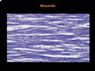 Miocardio
 