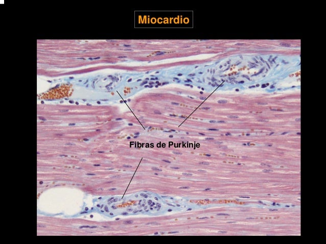 Resultado de imagen para fibras de purkinje del corazon