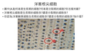 洋蔥根尖細胞
• 圖中(A.B)何者是生長期的細胞?何者是分裂期的細胞?你怎麼判斷?
• 洋蔥根尖細胞是生長期的細胞多?還是分裂期的細胞多?
• 你認為:洋蔥鱗葉細胞生長期的細胞多?還是分裂期的細胞多?為什麼?
 