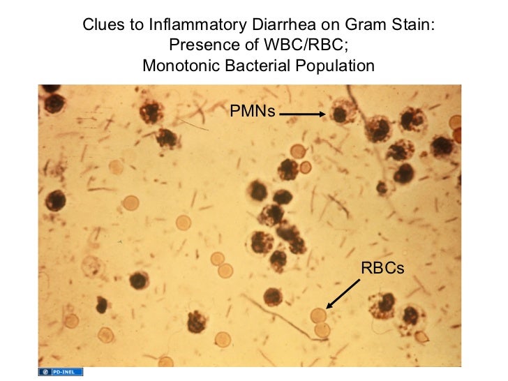 01.26.12 Diarrhea and Malabsorption