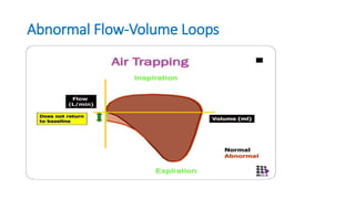 ventilation in neonates | PPTX