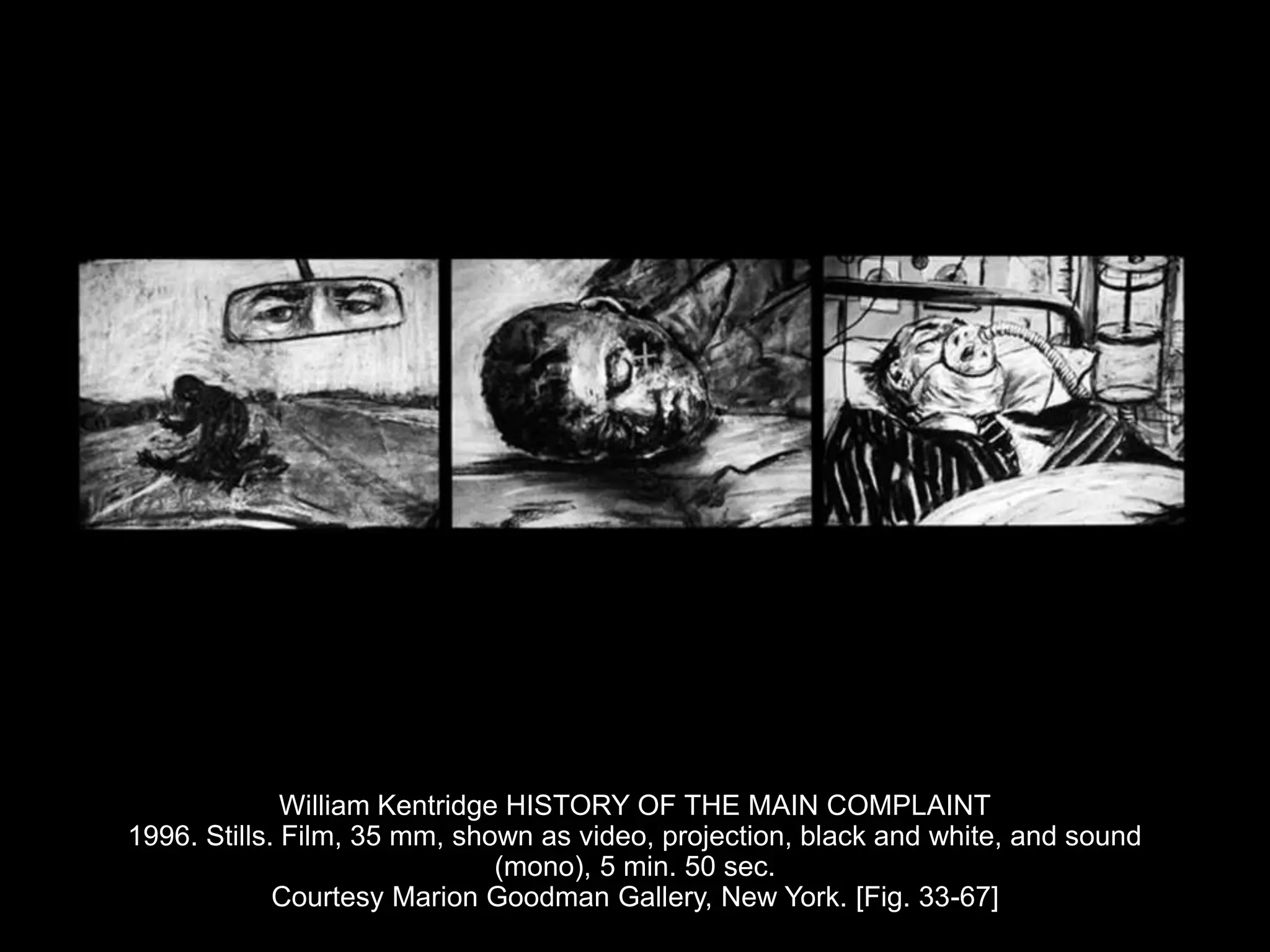 William Kentridge HISTORY OF THE MAIN COMPLAINT
1996. Stills. Film, 35 mm, shown as video, projection, black and white, and sound
(mono), 5 min. 50 sec.
Courtesy Marion Goodman Gallery, New York. [Fig. 33-67]
 