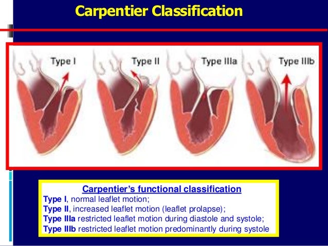 Lev Mendelevich MD — Trans Catheter Treatment of Structural Heart Dis…