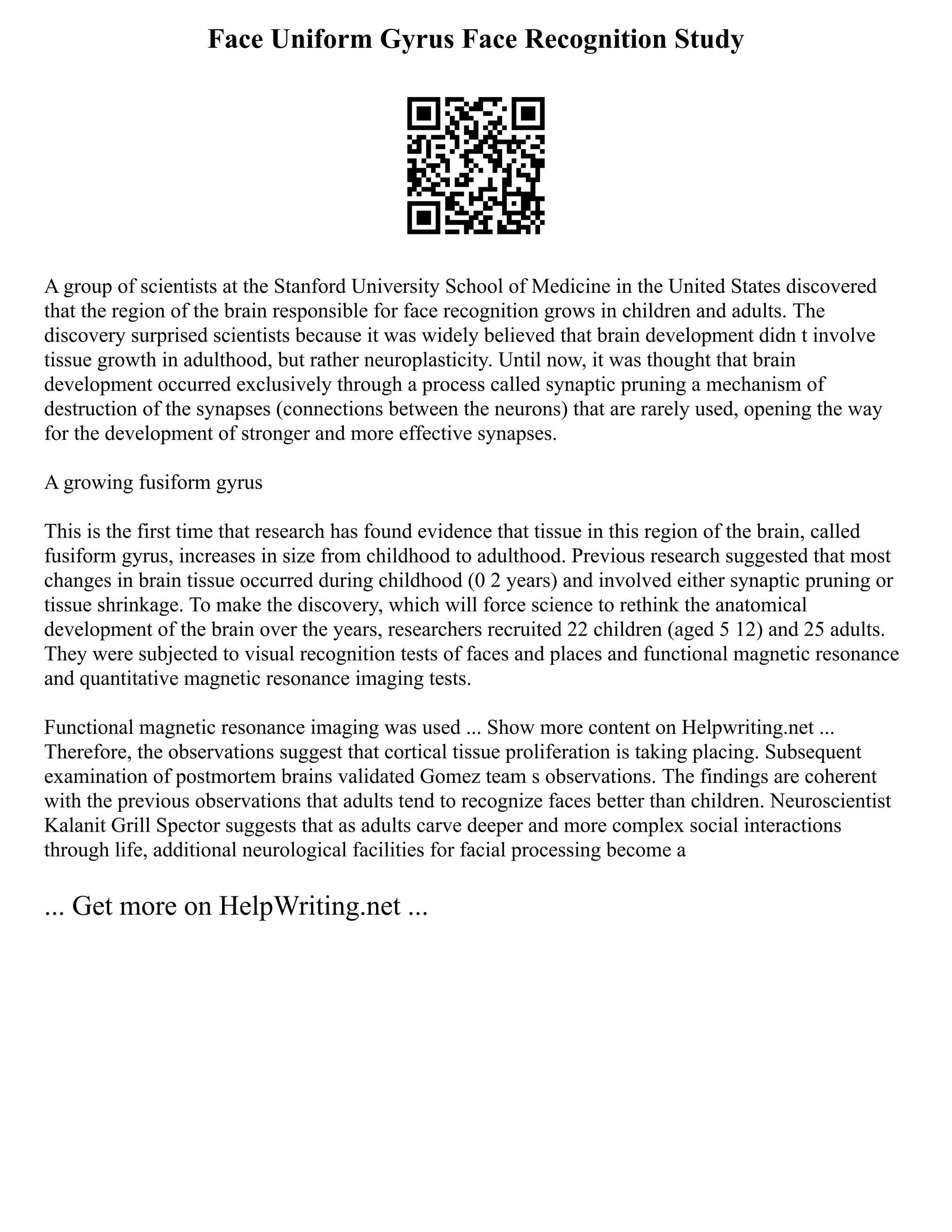 Face Uniform Gyrus Face Recognition Study
A group of scientists at the Stanford University School of Medicine in the United States discovered
that the region of the brain responsible for face recognition grows in children and adults. The
discovery surprised scientists because it was widely believed that brain development didn t involve
tissue growth in adulthood, but rather neuroplasticity. Until now, it was thought that brain
development occurred exclusively through a process called synaptic pruning a mechanism of
destruction of the synapses (connections between the neurons) that are rarely used, opening the way
for the development of stronger and more effective synapses.
A growing fusiform gyrus
This is the first time that research has found evidence that tissue in this region of the brain, called
fusiform gyrus, increases in size from childhood to adulthood. Previous research suggested that most
changes in brain tissue occurred during childhood (0 2 years) and involved either synaptic pruning or
tissue shrinkage. To make the discovery, which will force science to rethink the anatomical
development of the brain over the years, researchers recruited 22 children (aged 5 12) and 25 adults.
They were subjected to visual recognition tests of faces and places and functional magnetic resonance
and quantitative magnetic resonance imaging tests.
Functional magnetic resonance imaging was used ... Show more content on Helpwriting.net ...
Therefore, the observations suggest that cortical tissue proliferation is taking placing. Subsequent
examination of postmortem brains validated Gomez team s observations. The findings are coherent
with the previous observations that adults tend to recognize faces better than children. Neuroscientist
Kalanit Grill Spector suggests that as adults carve deeper and more complex social interactions
through life, additional neurological facilities for facial processing become a
... Get more on HelpWriting.net ...
 