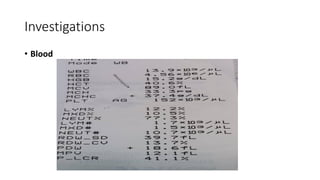 Investigations
• Blood
 