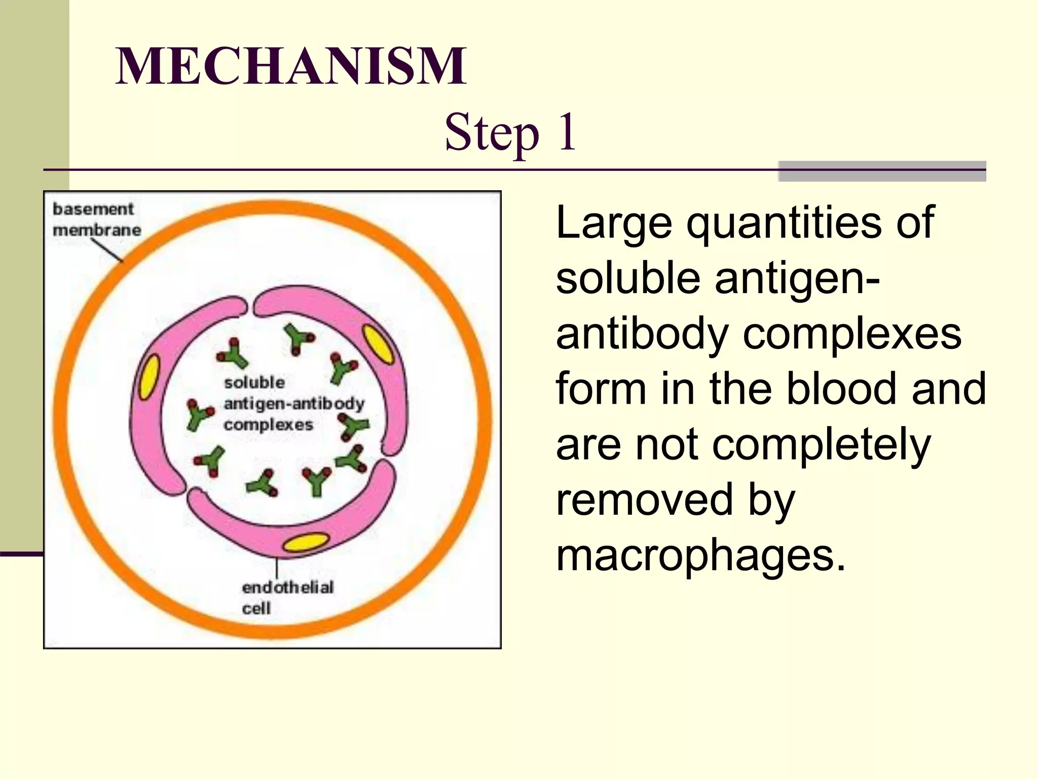 MECHANISM
Step 1
Large quantities of
soluble antigen-
antibody complexes
form in the blood and
are not completely
removed by
macrophages.
 