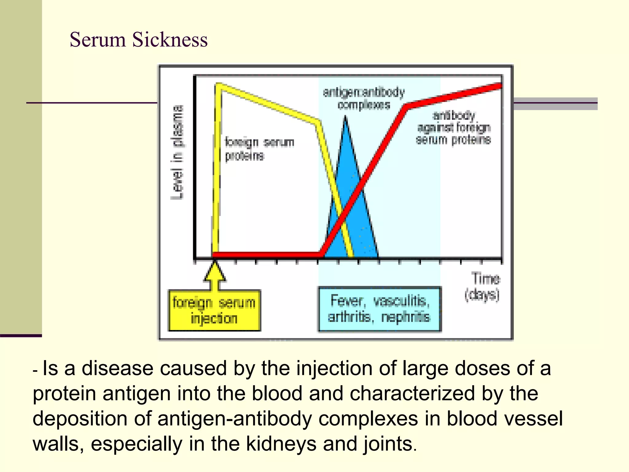Serum Sickness
- Is a disease caused by the injection of large doses of a
protein antigen into the blood and characterized by the
deposition of antigen-antibody complexes in blood vessel
walls, especially in the kidneys and joints.
 