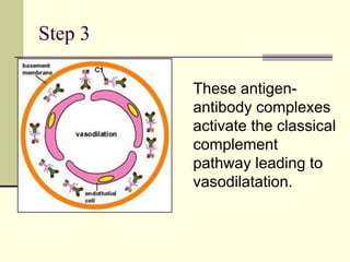 Step 3
These antigen-
antibody complexes
activate the classical
complement
pathway leading to
vasodilatation.
 