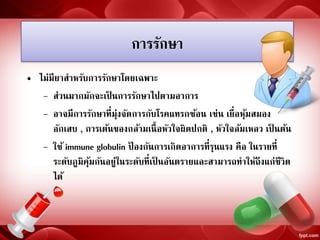 การรักษา
• ไม่มียาสาหรับการรักษาโดยเฉพาะ
– ส่วนมากมักจะเป็ นการรักษาไปตามอาการ
– อาจมีการรักษาที่มุ่งจัดการกับโรคแทรกซ้อน เช่น เยื่อหุ้มสมอง
อักเสบ , การเต้นของกล้ามเนื้อหัวใจผิดปกติ , หัวใจล้มเหลว เป็ นต้น
– ใช้ immune globulin ป้ องกันการเกิดอาการที่รุนแรง คือ ในรายที่
ระดับภูมิคุ้มกันอยู่ในระดับที่เป็ นอันตรายและสามารถทาให้ถึงแก่ชีวิต
ได้
 