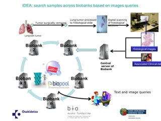 Biobank 3 
Biobank 4 
Biobank n 
Biobank 1 
Biobank 2 
Tumor surgically removed 
Lung tumor processed 
to histological slide 
Lung with tumor 
Digital scanning of histological sections 
Central server of Biobank 
Histological images 
Associated Clinical data 
Text and image queries 
IDEA: search samples across biobanks based on images queries  