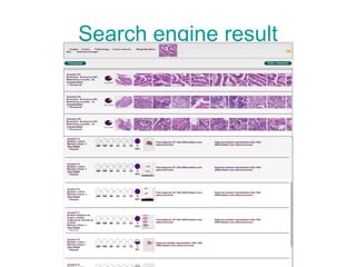 Search engine result 
 