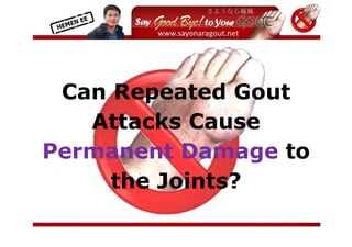  
          


          



 Can Repeated Gout
   Attacks Cause
Permanent Damage to
     the Joints?
                       
 